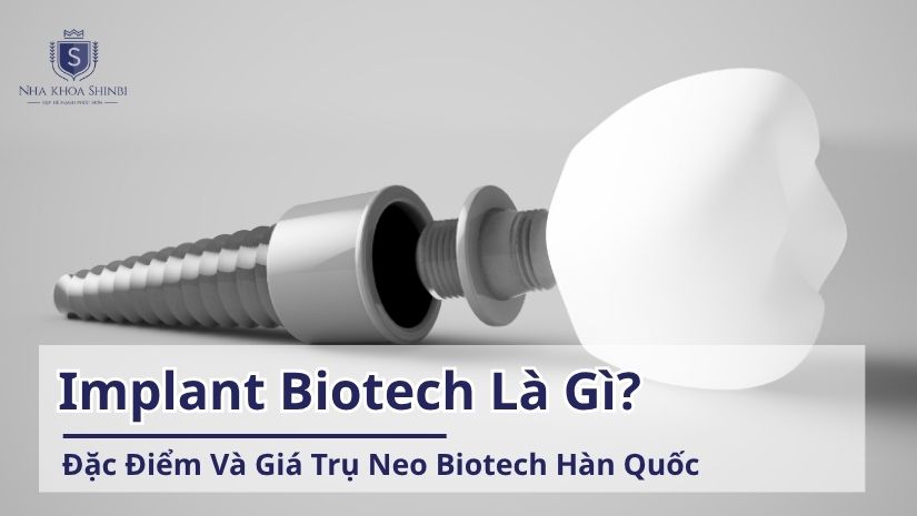 Implant Biotech là gì? Đặc điểm và giá trụ Neo Biotech Hàn Quốc