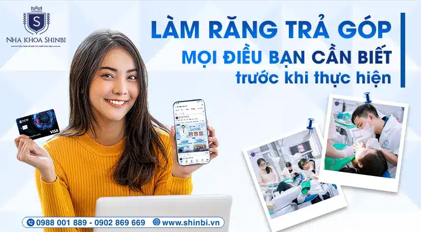 Làm răng trả góp: Mọi điều bạn cần biết trước khi thực hiện