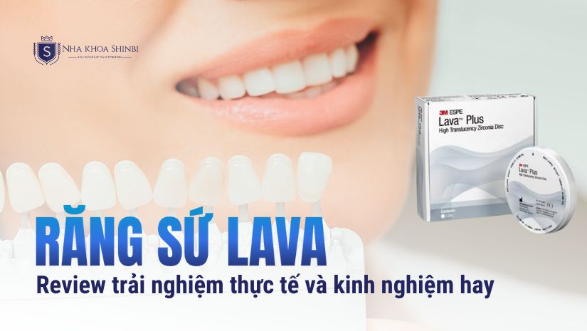 Bọc răng sứ Lava: Tất tần tật từ A đến Z [BÁC SĨ GIẢI ĐÁP]