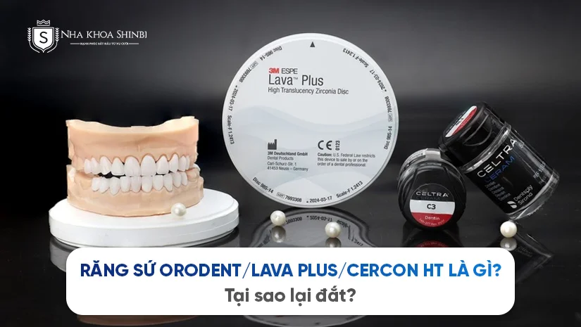 Răng sứ Orodent, Lava Plus, Cercon HT là gì? Tại sao lại đắt?