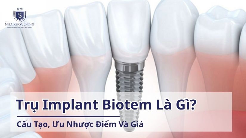 Trụ Implant Biotem-Tìm Hiểu Xuất Xứ, Cấu Tạo Và Chi Phí