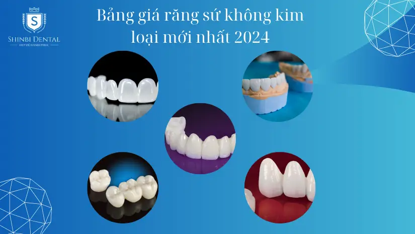 Bọc răng sứ không kim loại giá bao nhiêu? Bảng giá