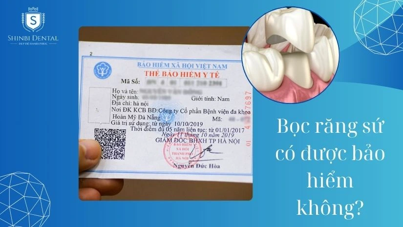 Bọc răng sứ có được bảo hiểm Y tế chi trả không?
