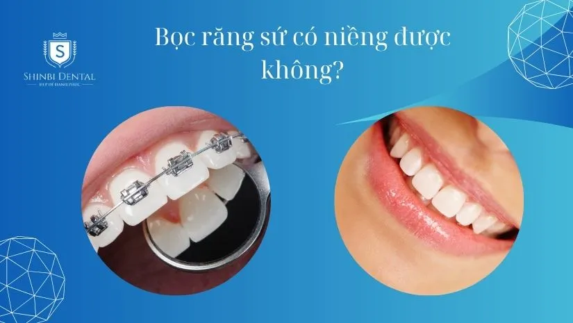 Bọc răng sứ có niềng được không? Khi nào niềng được?