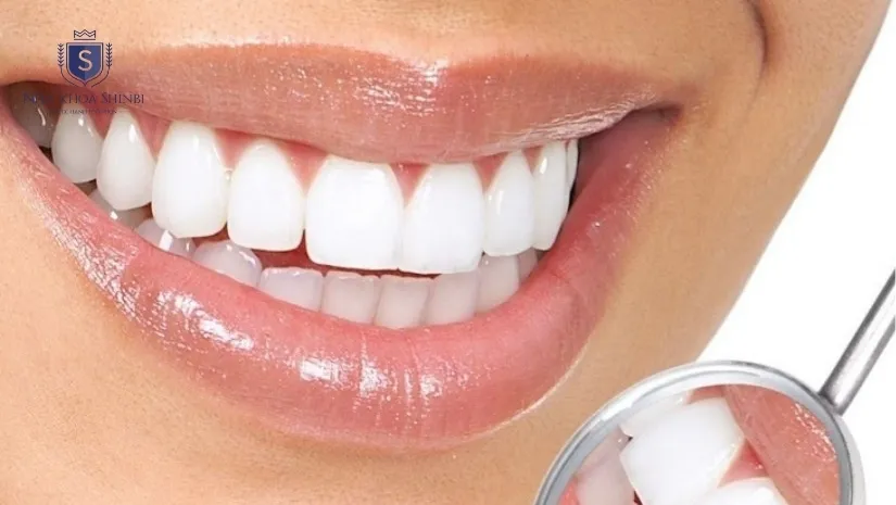 Bọc răng sứ Đức là gì? Ưu điểm, Các loại và Bảng giá