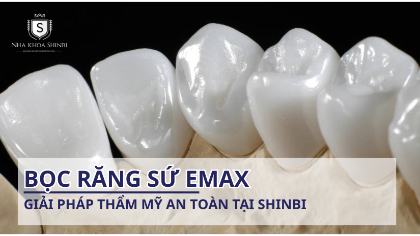 Bọc răng sứ Emax - Giải pháp thẩm mỹ an toàn tại Shinbi