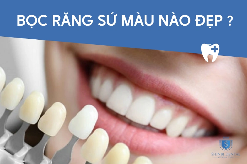 Bọc răng sứ màu nào đẹp, tự nhiên nhất hiện nay 2025