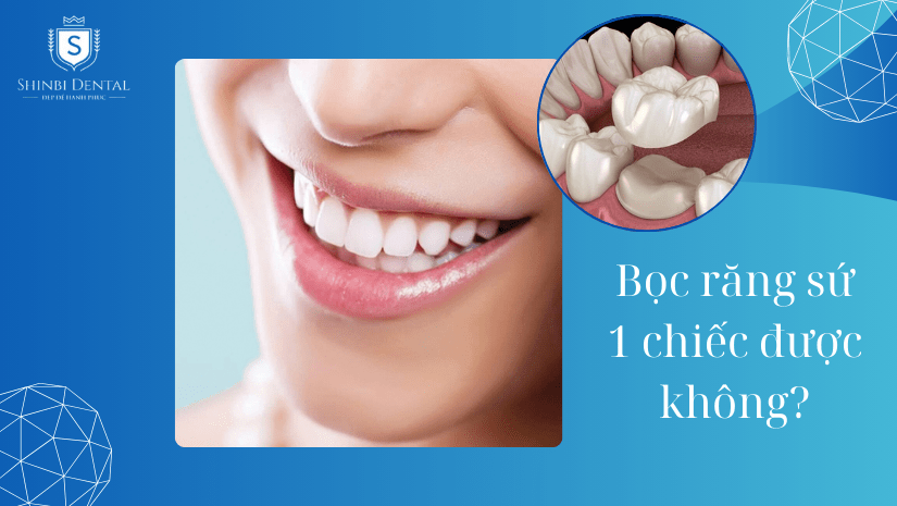Bọc răng sứ 1 chiếc được không? Chi phí bao nhiêu?