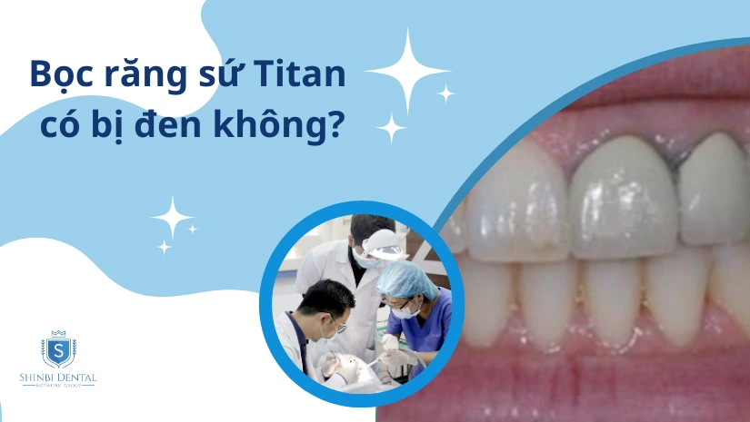 Bọc răng sứ Titan có bị đen không? Cách khắc phục