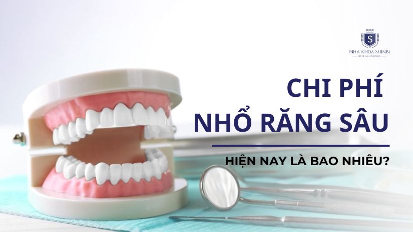 Chi phí nhổ răng sâu hiện nay là bao nhiêu?