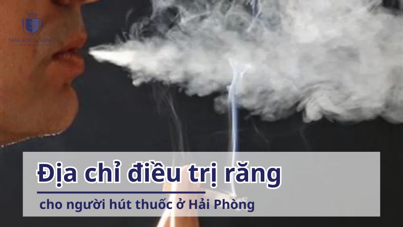 Địa chỉ điều trị răng cho người hút thuốc tại Hải Phòng