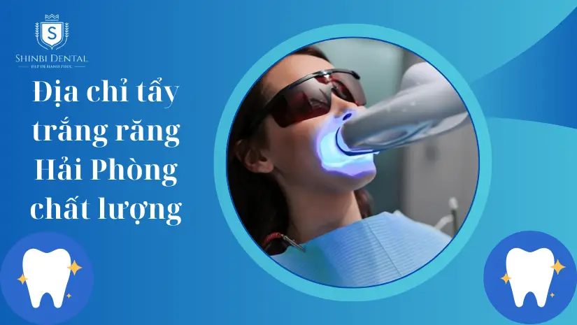 10 địa chỉ tẩy trắng răng ở Hải Phòng uy tín, tốt nhất