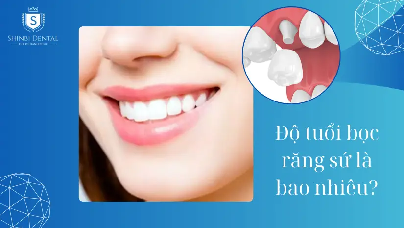 Độ tuổi bọc răng sứ lý tưởng dành cho trẻ em, người lớn