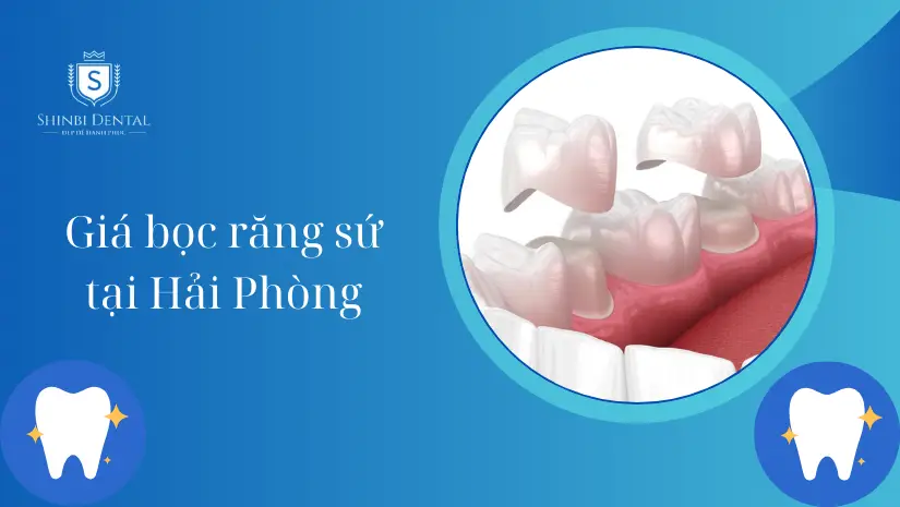 Giá bọc răng sứ tại Hải Phòng và những yếu tố ảnh hưởng