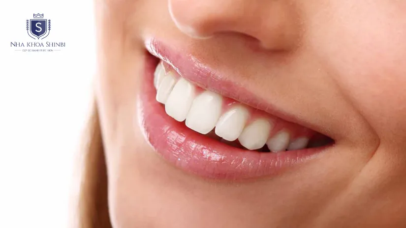 Giá răng sứ thẩm mỹ bao nhiêu tiền? Bảng giá cập nhật 2024