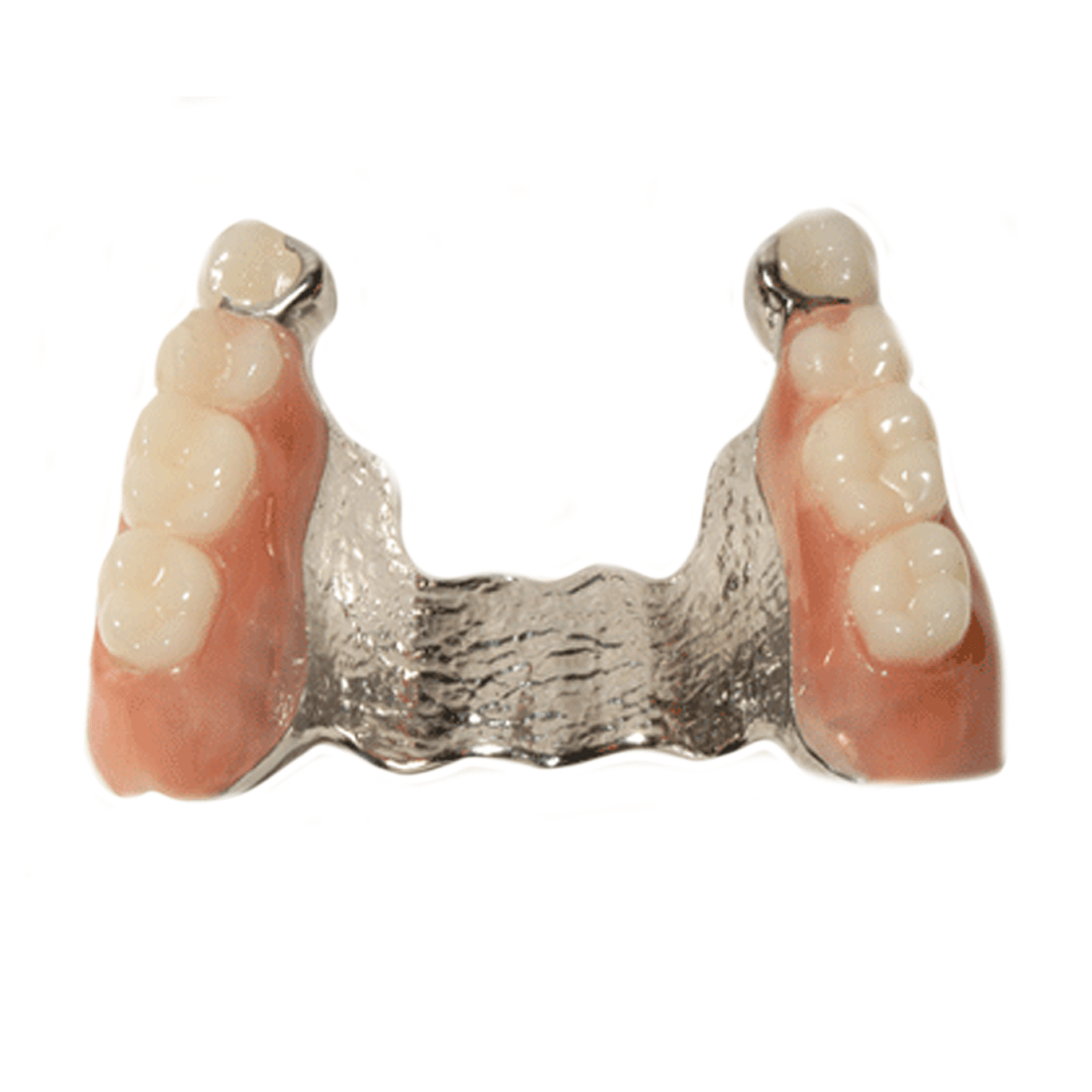 Nền tháo lắp khung Titan