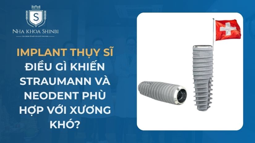 Trụ Implant Thụy Sĩ: Xuất Xứ, Mức Giá Và Ưu Nhược Điểm