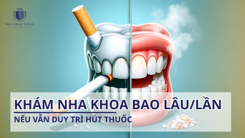 Khám nha khoa bao lâu/lần nếu vẫn duy trì hút thuốc?