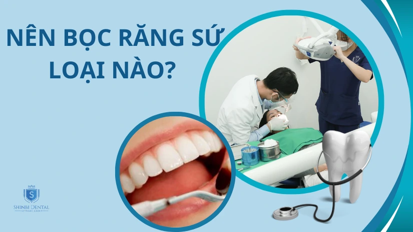 Nên bọc răng sứ loại nào tốt, đẹp nhất hiện nay?