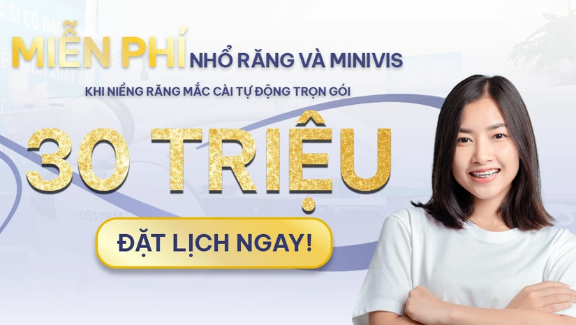 Niềng răng mắc cài tự động trọn gói chỉ 30 triệu