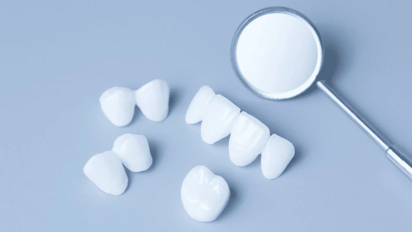 Răng sứ cao cấp: Các loại và bảng giá bọc răng