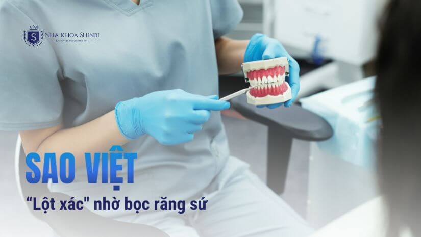 Điểm danh những sao Việt “lột xác” nhờ bọc răng sứ 
