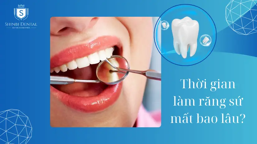 Thời gian làm răng sứ mất bao nhiêu lâu thì bình thường?