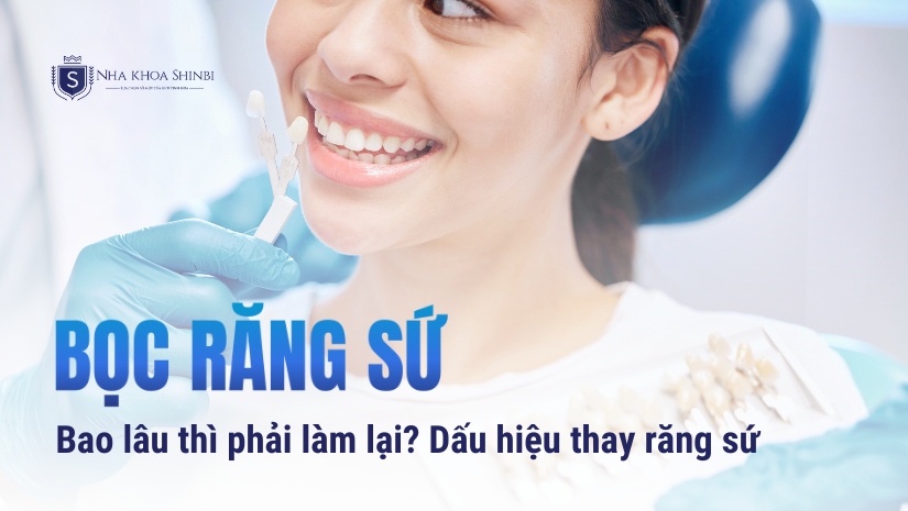Bọc răng sứ bao lâu thì phải làm lại? Dấu hiệu thay răng sứ